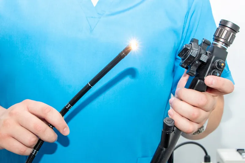 Koloskopie ohne Angst: Meine ehrliche Erfahrung